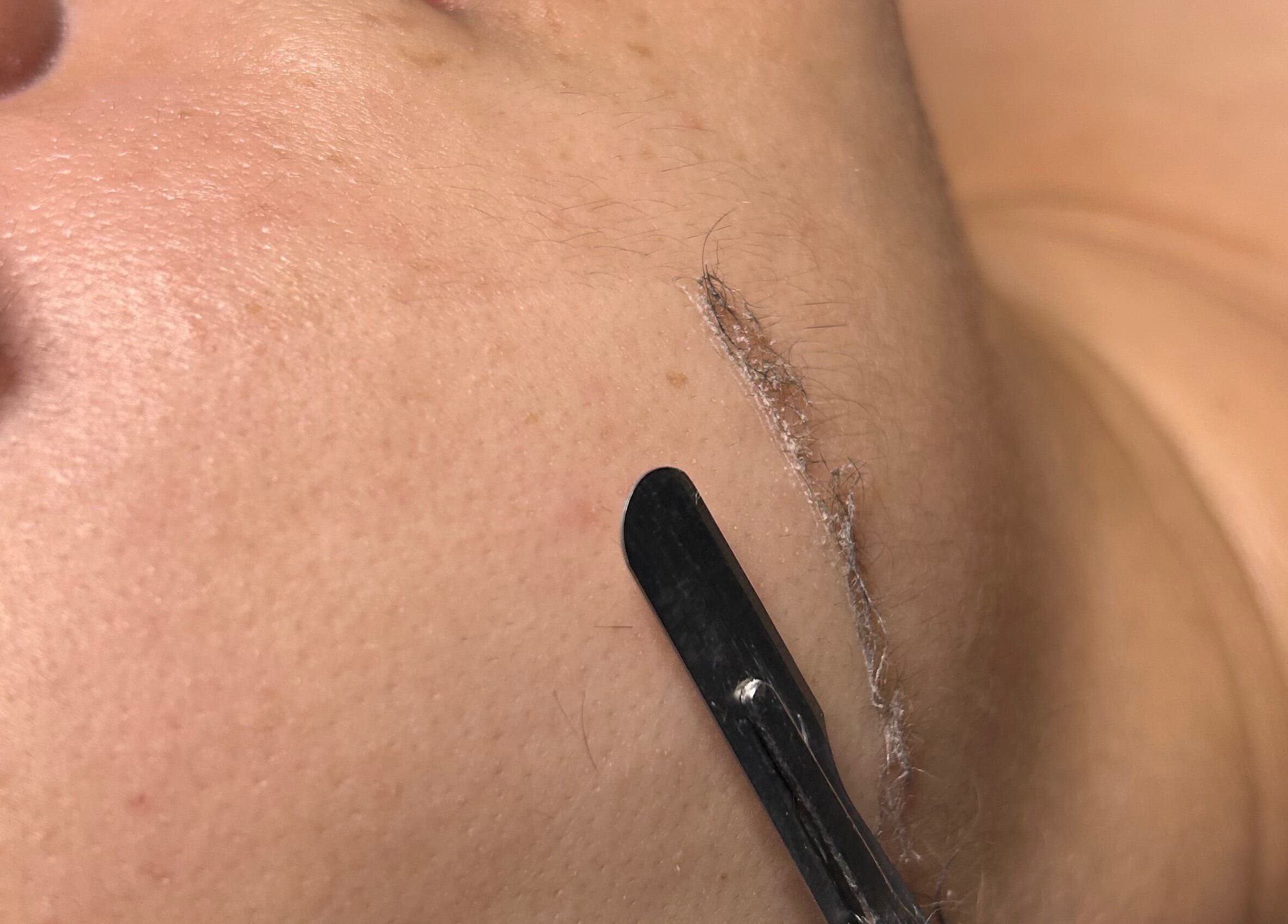 Tratamiento facial en Estroesthetics, Guaynabo, Guaynabo, PR para mejorar la apariencia de la piel.