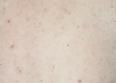 Close-up of skin texture showcased at Sara Raquel Beauty, Navan, County Meath, IE.