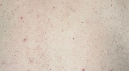 Close-up of skin texture showcased at Sara Raquel Beauty, Navan, County Meath, IE.