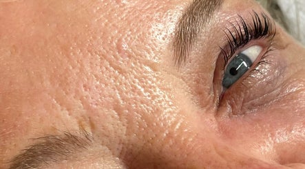 Brightened eye area after skincare treatment at Georgia Grace Beauty, Berry, New South Wales, AU.