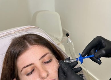 AESTHETICS. By Nurse Ryan offers dermal fillers in Glasgow, Scotland, GB with precise and professional care.