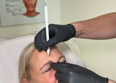 Botox treatment at AESTHETICS. By Nurse Ryan, Glasgow, Scotland, GB, showcasing precision and care.