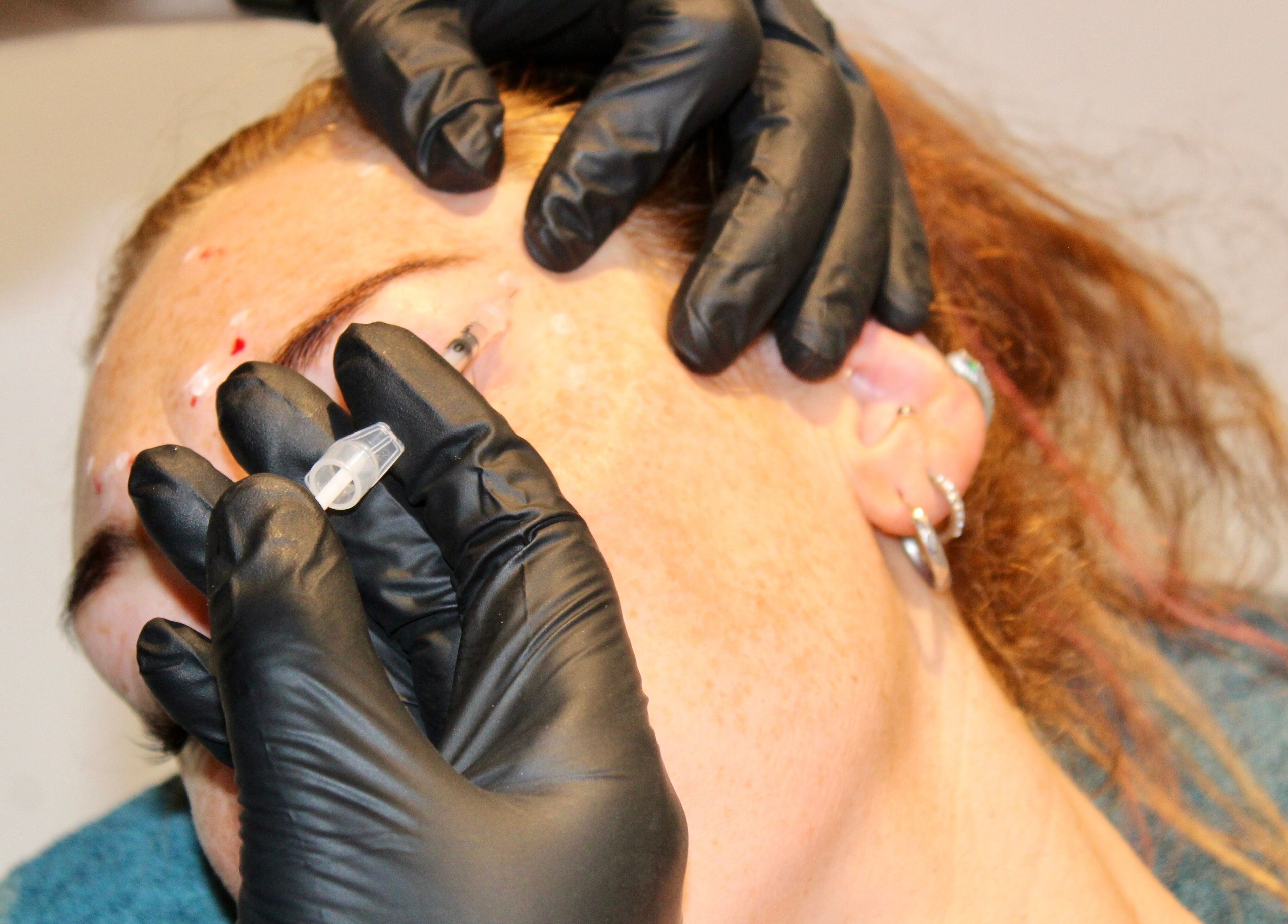 Injectable treatment at Valkyrie Performance and Aesthetics, Norwich, England, GB.