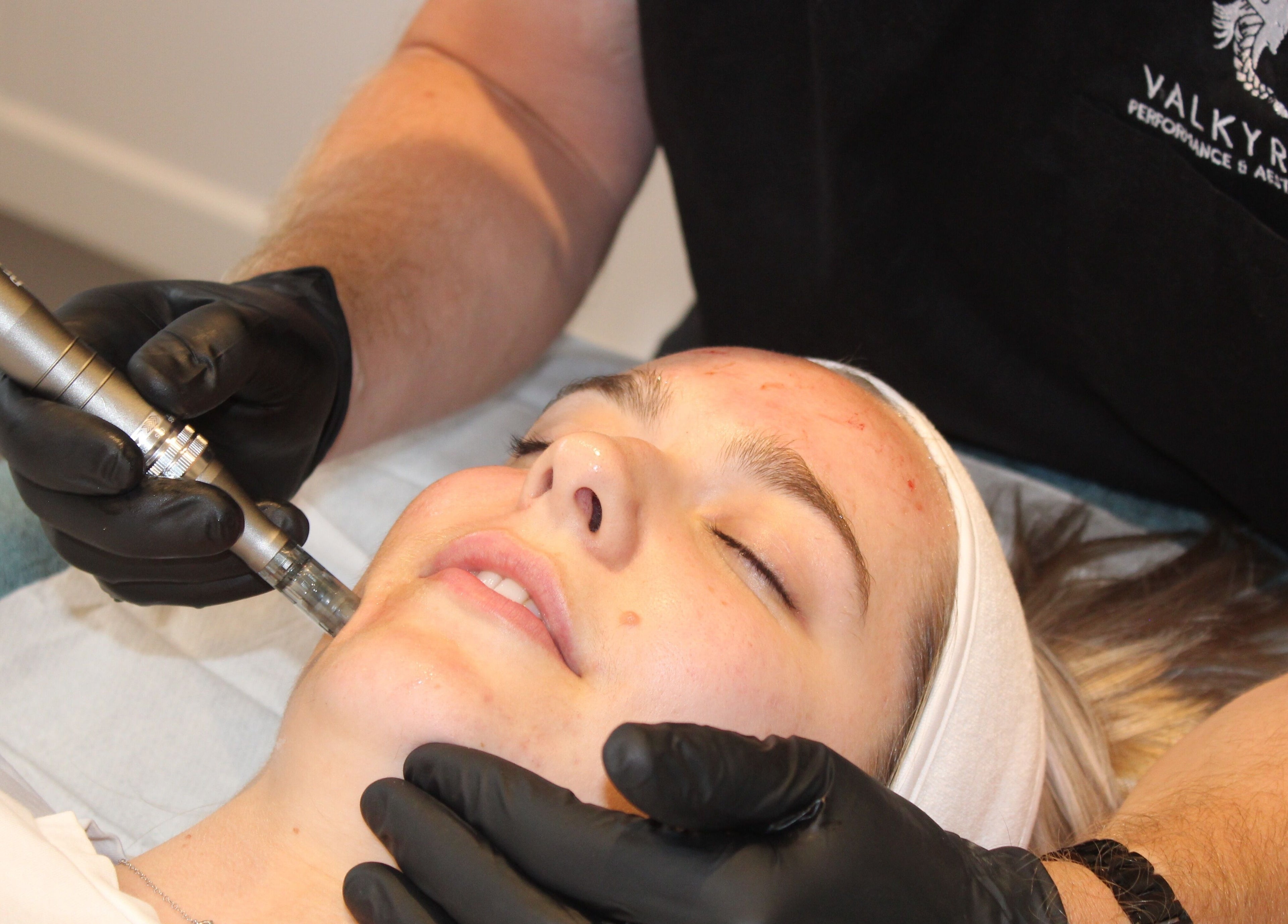 Facial treatment at Valkyrie Performance and Aesthetics, Norwich, England, GB enhancing skin appearance.