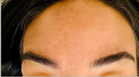 Close-up of smooth forehead after treatment at Abi Peters Aesthetics (Denmead), Denmead, England, GB.