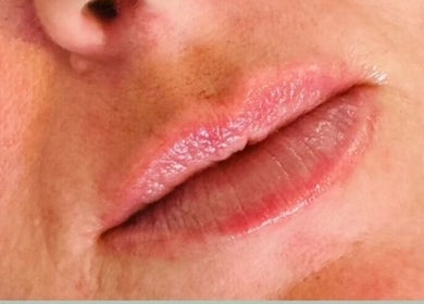Close-up of lips at Abi Peters Aesthetics (Bedhampton), Bedhampton, United Kingdom, GB, showing subtle makeup.