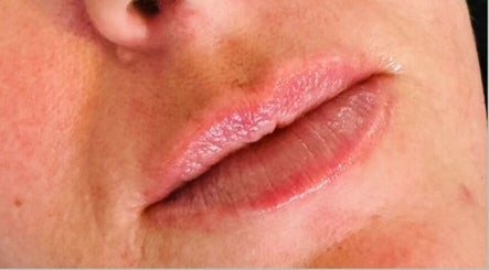 Close-up of lips at Abi Peters Aesthetics (Bedhampton), Bedhampton, United Kingdom, GB, showing subtle makeup.