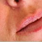 Abi Peters Aesthetics (Denmead)
