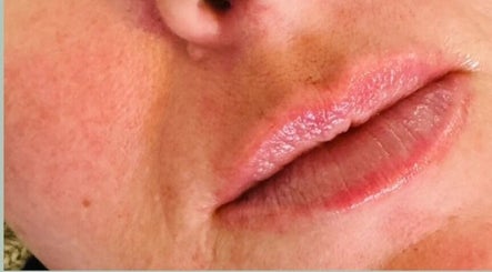 Closeup of rejuvenated lips at Abi Peters Aesthetics (Denmead), showcasing skin care in Denmead, England, GB.
