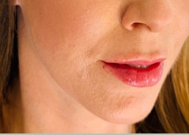 Close-up of radiant lips at Abi Peters Aesthetics (Denmead), showcasing beauty services in Denmead, England, GB.