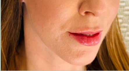Close-up of radiant lips at Abi Peters Aesthetics (Denmead), showcasing beauty services in Denmead, England, GB.