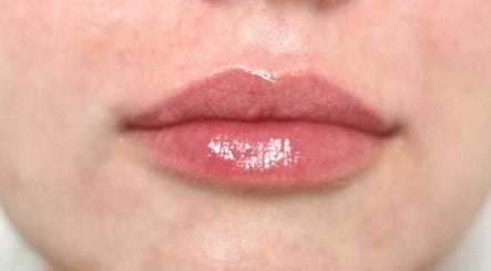 London Lip Clinic изображение 3