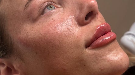 Close-up of a radiant face post-treatment at Aesthetic Affairs, Leicester, England, GB.