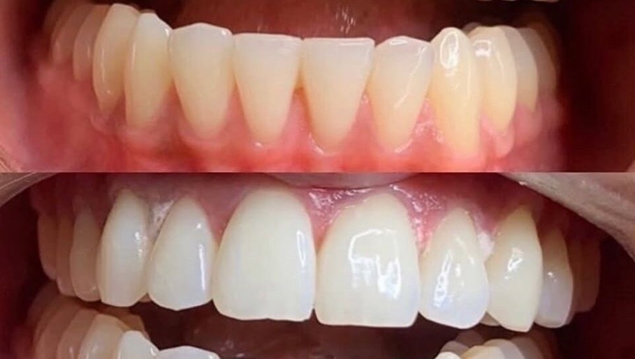 The Tooth Fairy image 1