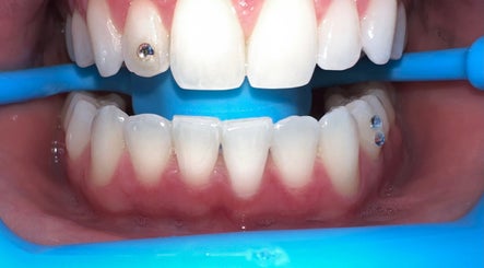The Tooth Fairy image 2