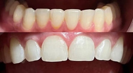 The Tooth Fairy image 3