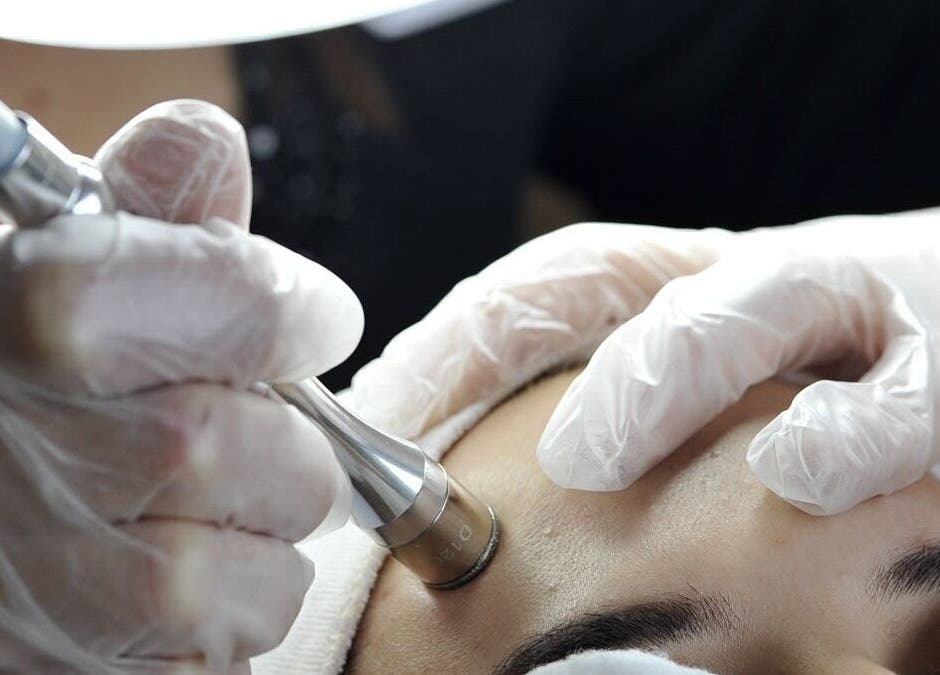 A microdermabrasion session at BROOKÈSKINCARE in Marbella, Andalucía, ES rejuvenating facial skin.