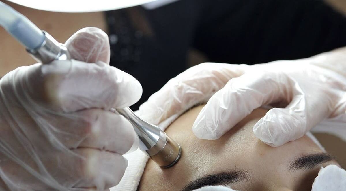 A microdermabrasion session at BROOKÈSKINCARE in Marbella, Andalucía, ES rejuvenating facial skin.