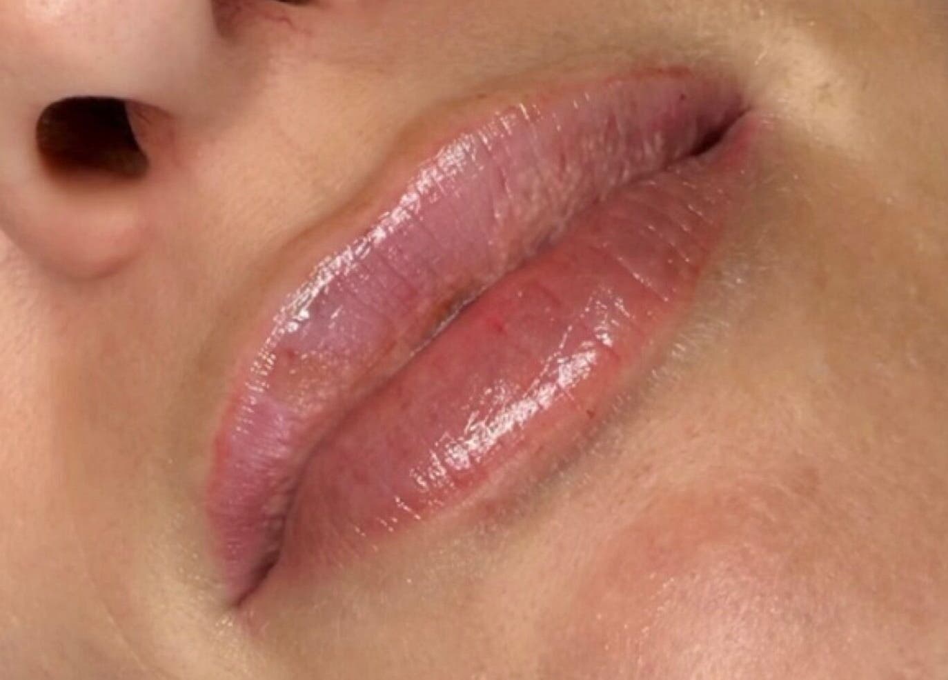 Close-up of glossy lips pampered at BROOKÈSKINCARE, Marbella, Andalucía, ES.