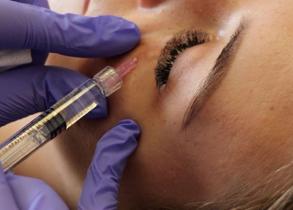 BROOKÈSKINCARE facial treatment in Marbella, Andalucía, ES featuring precise skincare injection.