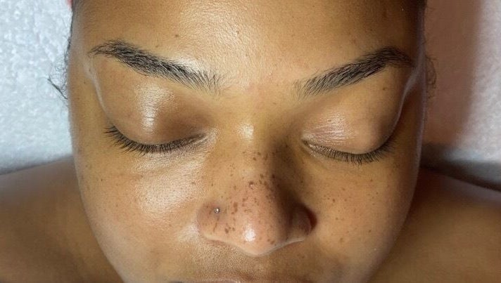 Peaceful face during treatment at SkinDeep, Nassau, New Providence, BS.