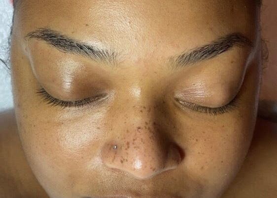 Peaceful face during treatment at SkinDeep, Nassau, New Providence, BS.