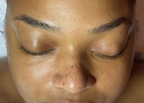 Peaceful face during treatment at SkinDeep, Nassau, New Providence, BS.