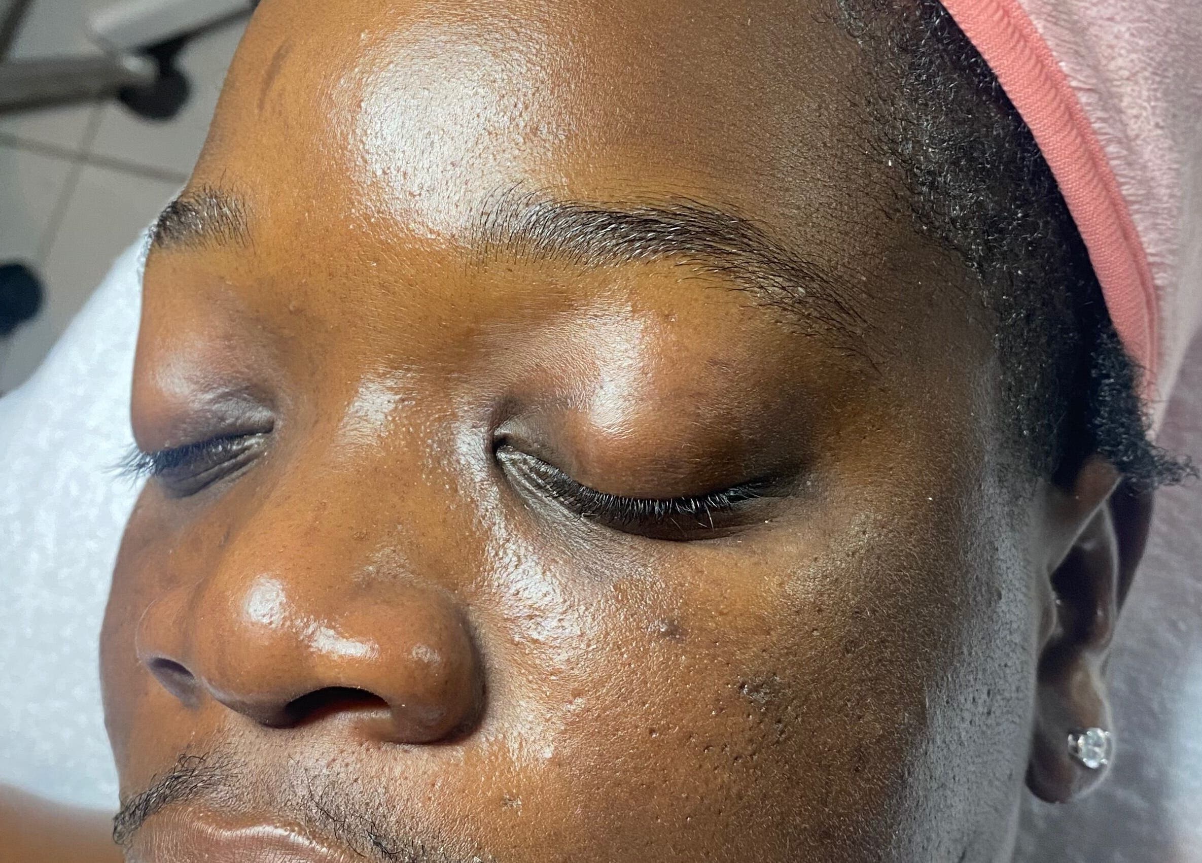 Close-up of a relaxed person at SkinDeep in Nassau, New Providence, BS, receiving a facial treatment.