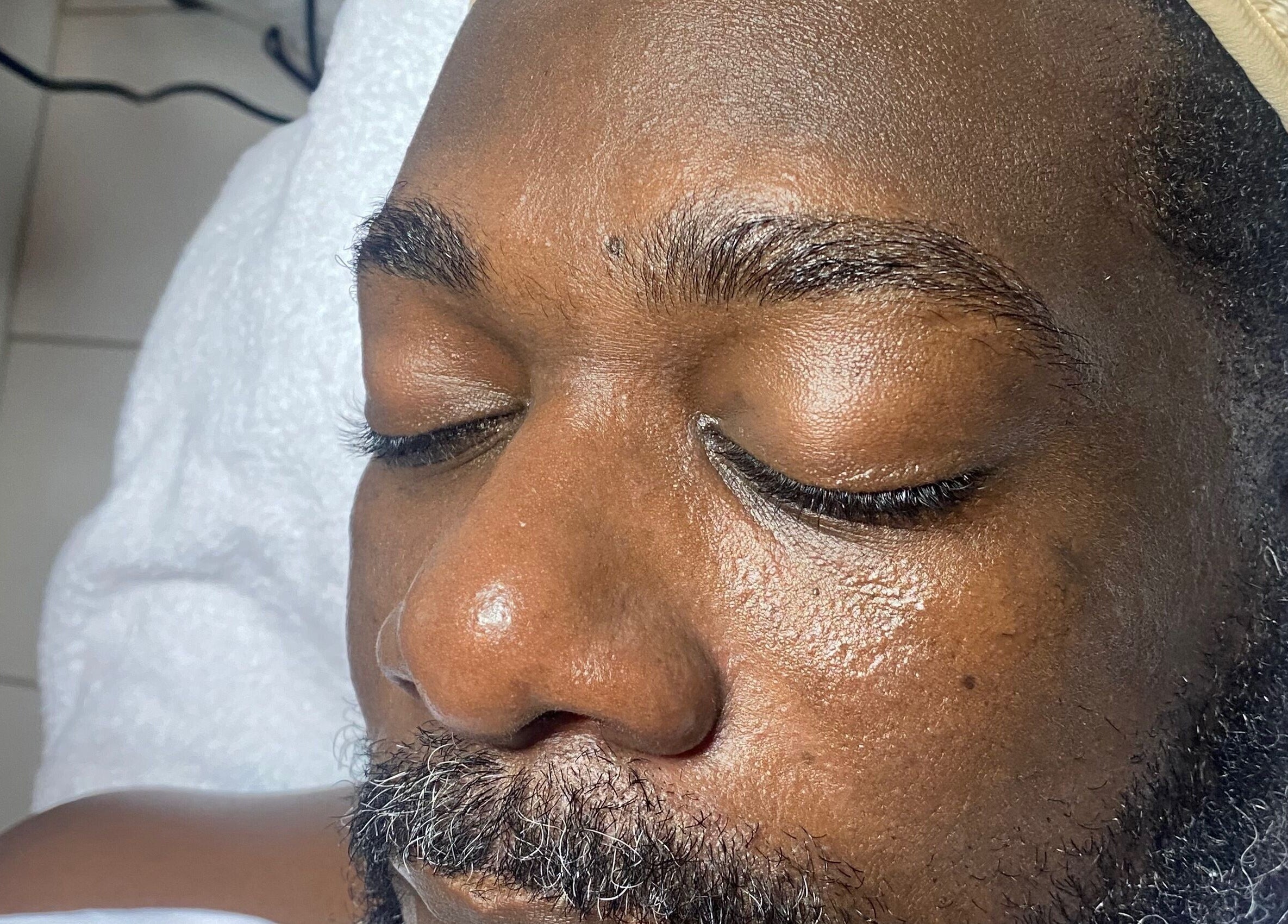 Face undergoing treatment at SkinDeep in Nassau, New Providence, BS, highlighting relaxation and skincare.