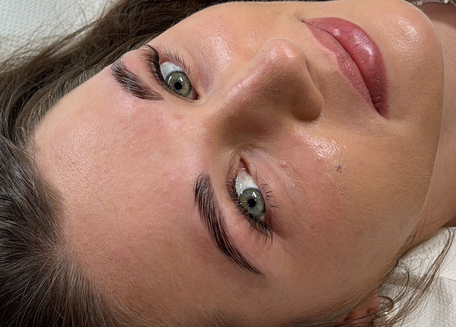 Close-up of a client's glowing skin after treatment at Aiia Clinic in London, England, GB.