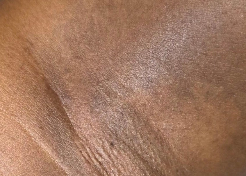 Close-up of freshly moisturized skin at Lūmena Studios, Kingston, St. Andrew Parish, JM.