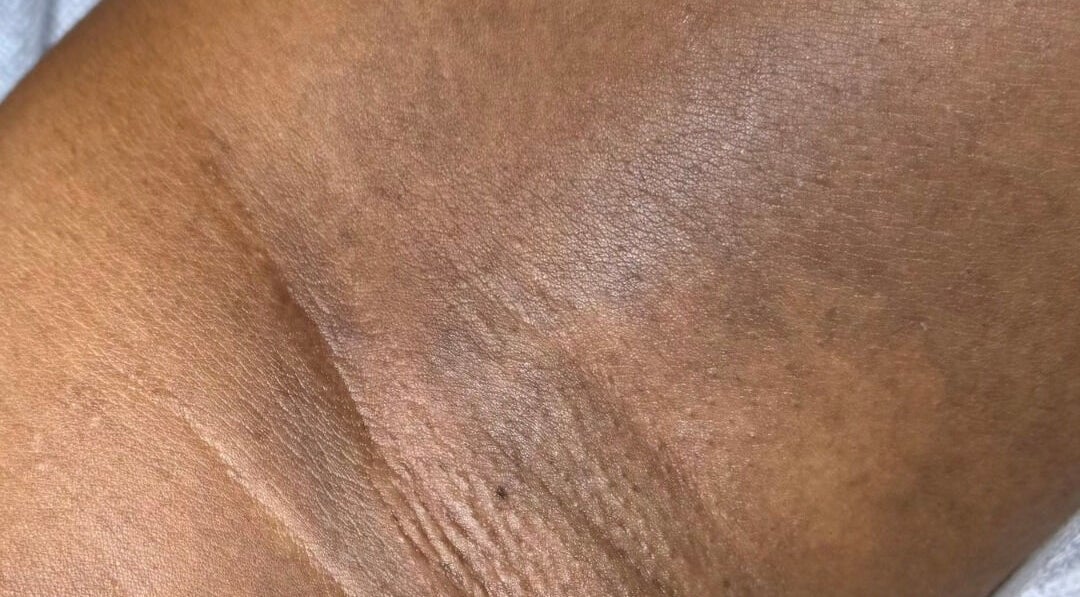 Close-up of freshly moisturized skin at Lūmena Studios, Kingston, St. Andrew Parish, JM.