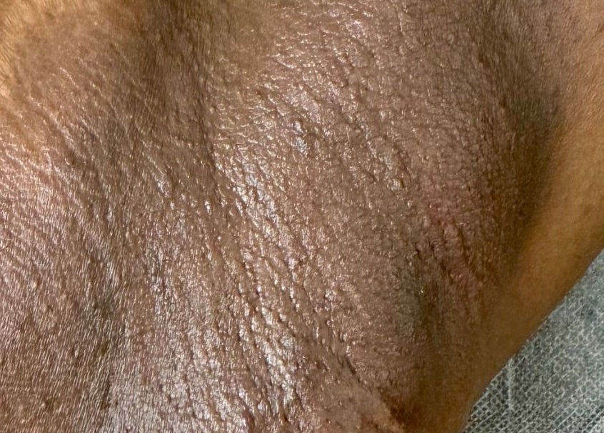 Close-up of hydrated skin after treatment at Lūmena Studios, Kingston, St. Andrew Parish, JM.