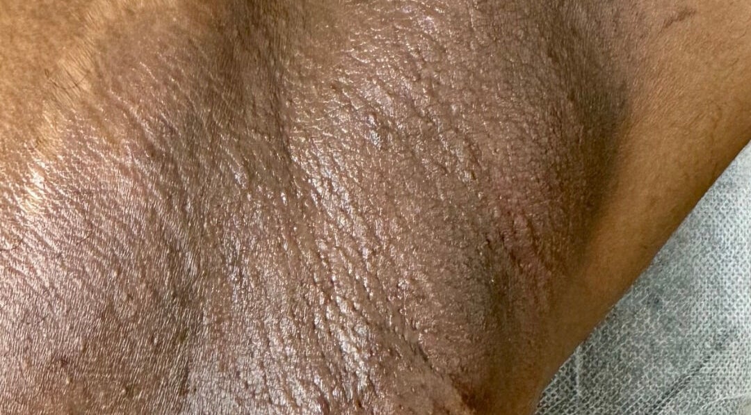 Close-up of hydrated skin after treatment at Lūmena Studios, Kingston, St. Andrew Parish, JM.