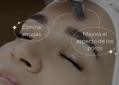 Tratamiento facial en Andreamlestetica, Pedralba, Comunidad Valenciana, ES, eliminando arrugas y mejorando poros.