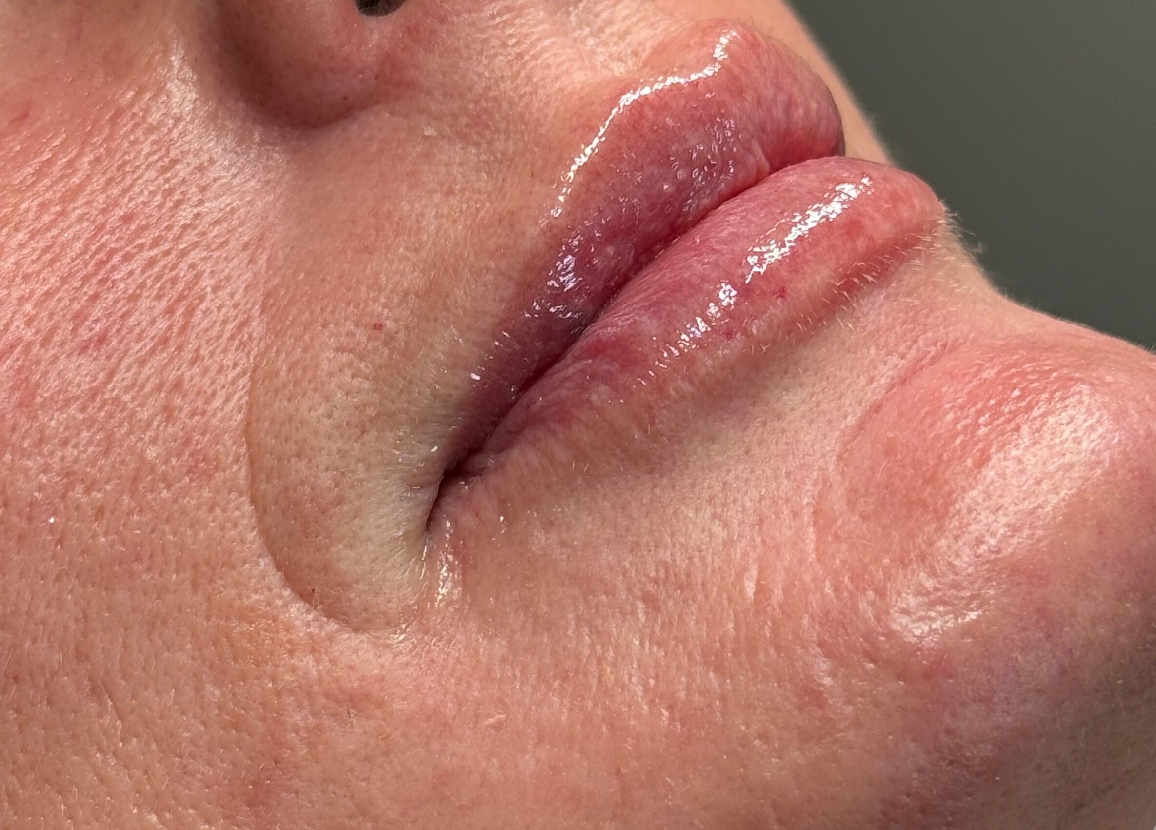 Close-up of glossy lips treatment at BEAUTIMAX in Stockport, England, GB, showcasing smooth skin and enhancement.