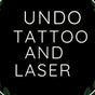 Undo Tattoo and Laser