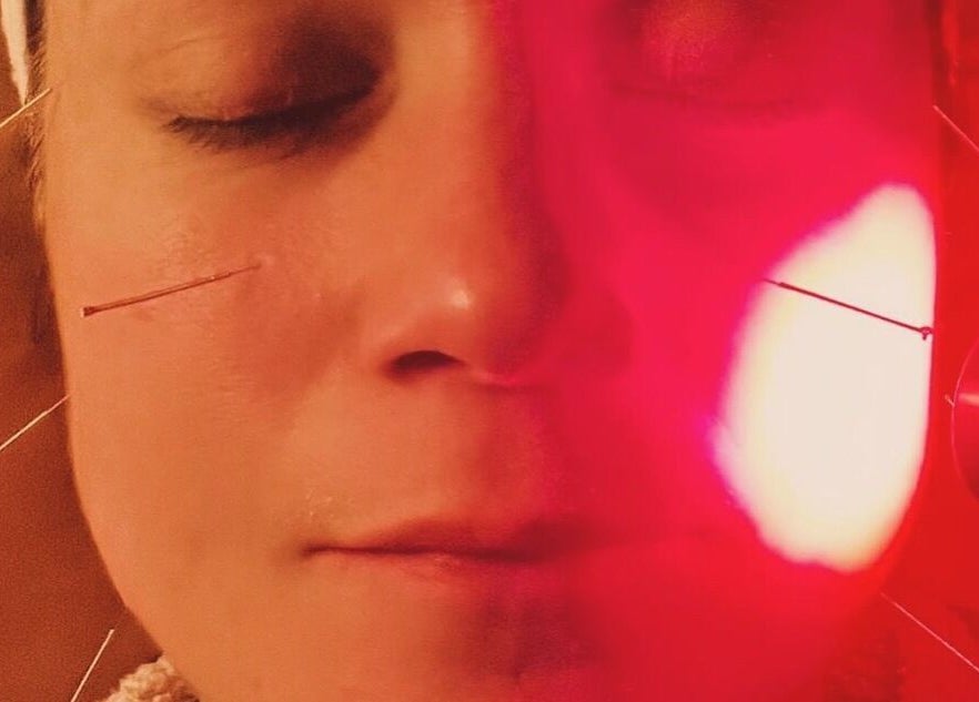 Facial acupuncture with red light at Breathe and Bloom Holistics, Wakefield, England, GB.