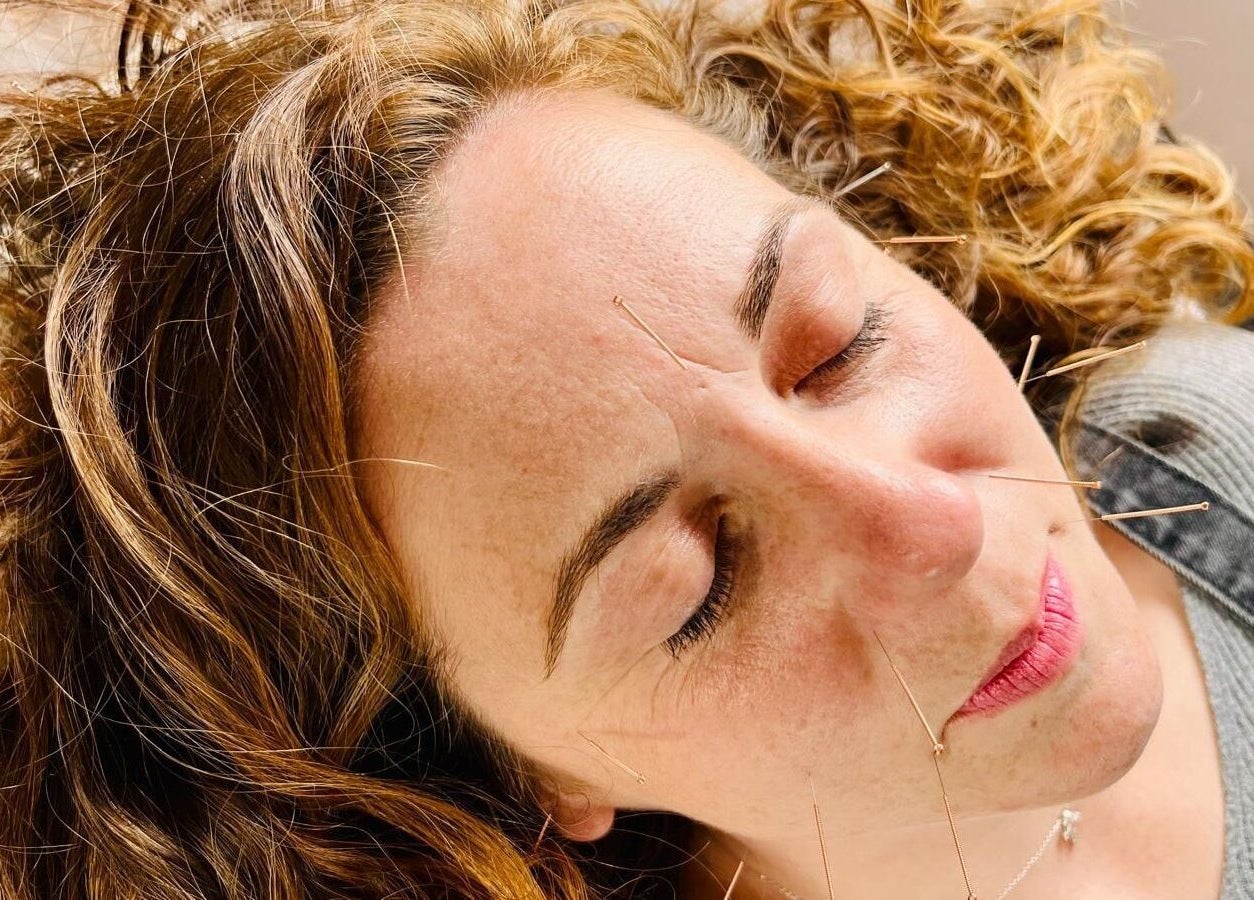 Relaxing acupuncture session at Breathe and Bloom Holistics, Wakefield, England, GB promoting wellness.