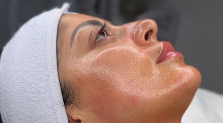 skin. image 2