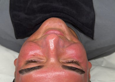 Client with a glowing face post-treatment at J Ludusan Beauty, Dublin, County Dublin, IE.