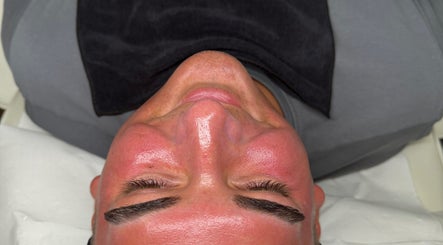 Client with a glowing face post-treatment at J Ludusan Beauty, Dublin, County Dublin, IE.