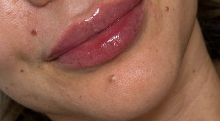 Glossy, well-groomed lips at J Ludusan Beauty, Dublin, County Dublin, IE for a perfect beauty look.