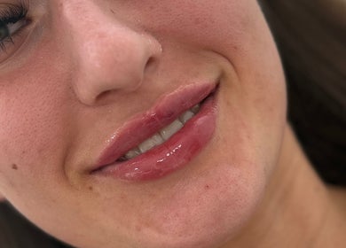 Close-up of glossy lips treatment at J Ludusan Beauty, Dublin, County Dublin, IE.