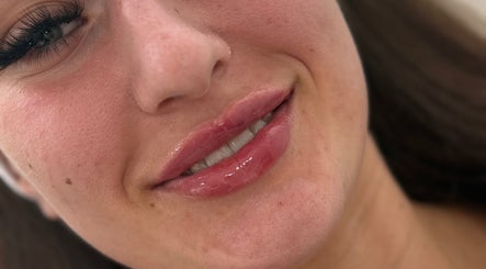 Close-up of glossy lips treatment at J Ludusan Beauty, Dublin, County Dublin, IE.