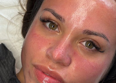 Close-up of a woman's face with glowing skin at J Ludusan Beauty, Dublin, County Dublin, IE.
