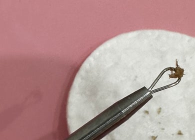 Precision tool at Dermal Glowz, Punchbowl, New South Wales, AU for flawless skin care.