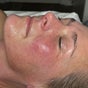 Desired Esthetics