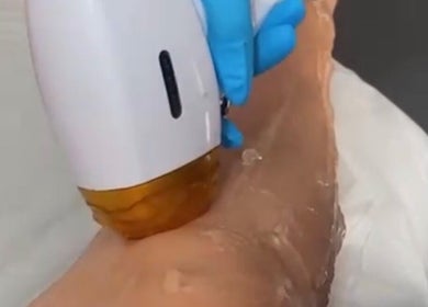 Tratamento a laser em Linha’S Definidas, Vila Nova De Famalicão, Braga, PT para uma pele lisa e saudável.