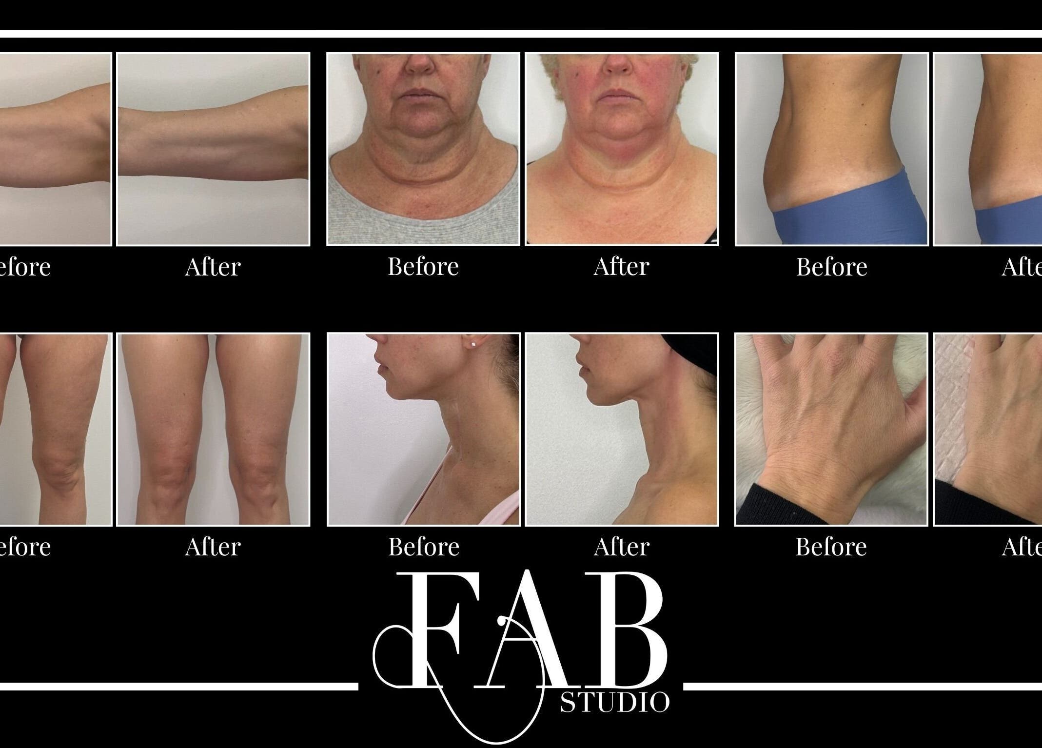 Before and after transformation results at FAB Studio, Neerabup, Western Australia, AU.